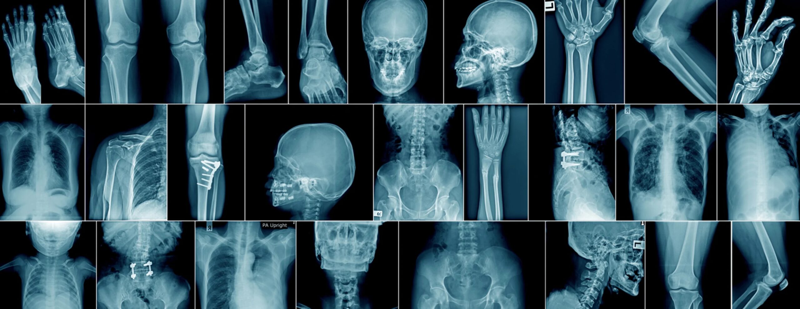 Ziua Internațională a Radiologiei